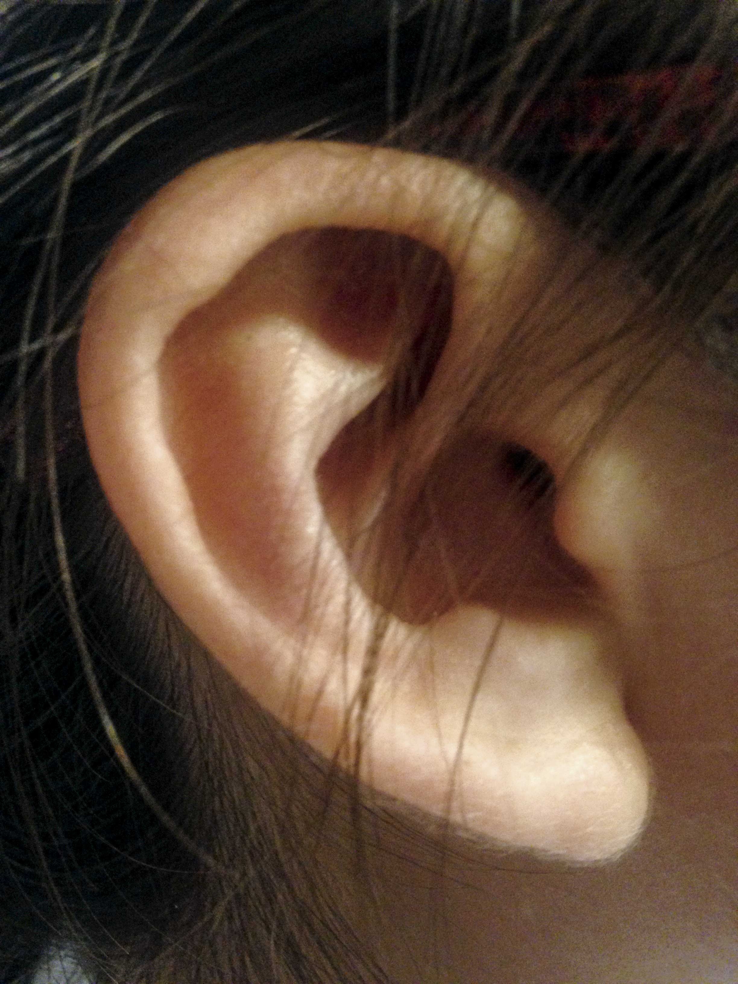 Discapacidad auditiva en Yucatán